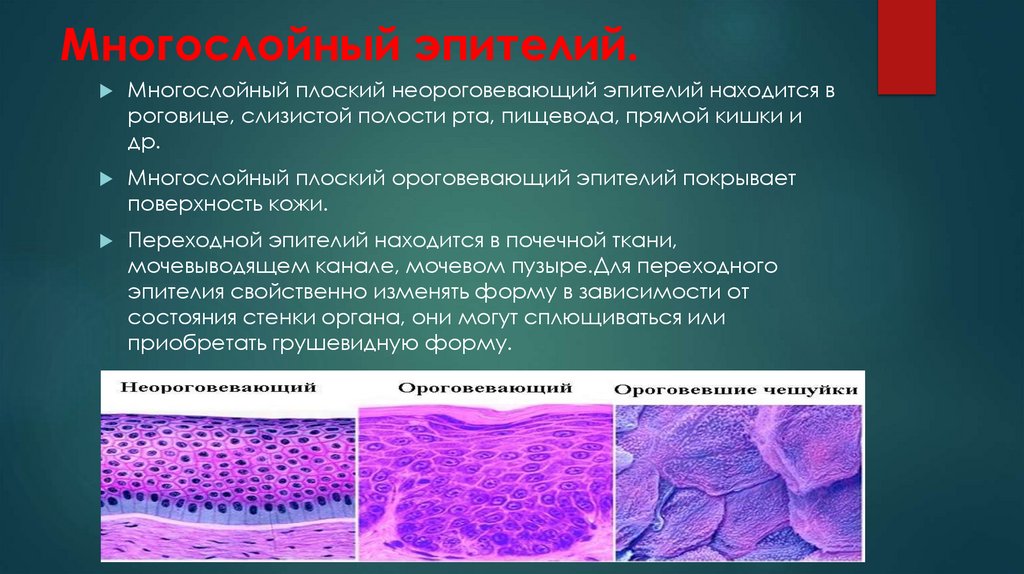 Многослойный эпителий.
