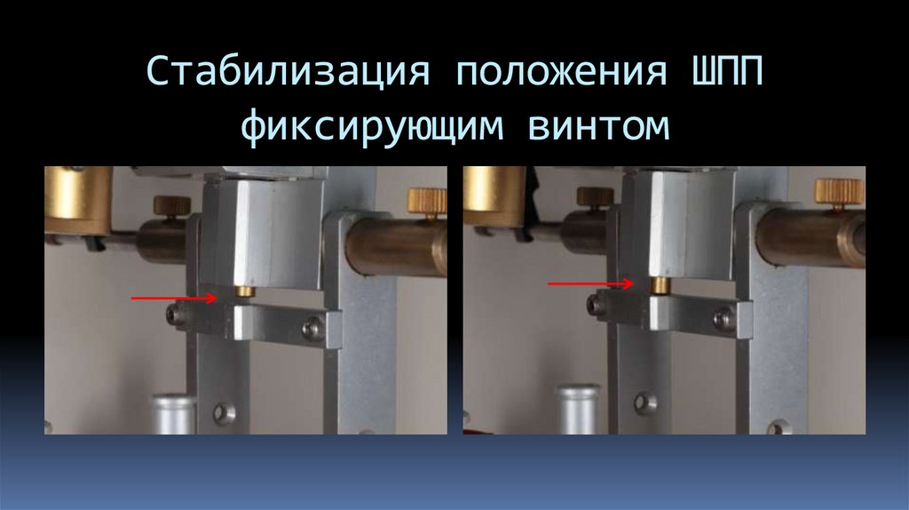 Стабилизация положения ШПП фиксирующим винтом