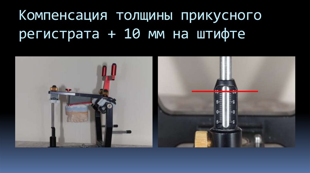 Компенсация толщины прикусного регистрата + 10 мм на штифте