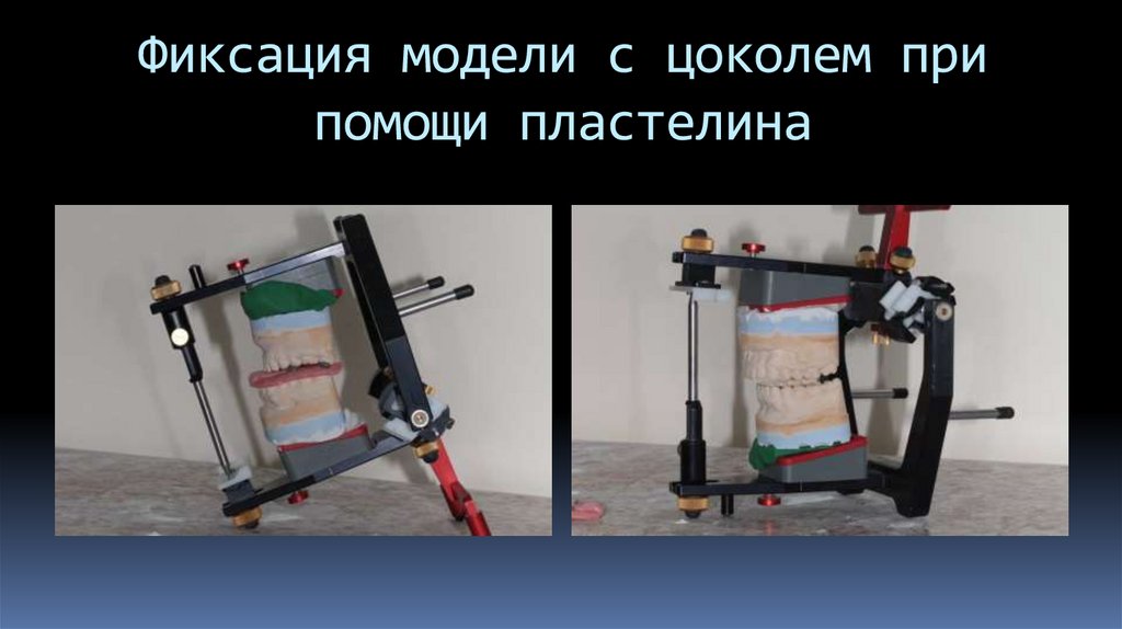 Фиксация модели с цоколем при помощи пластелина