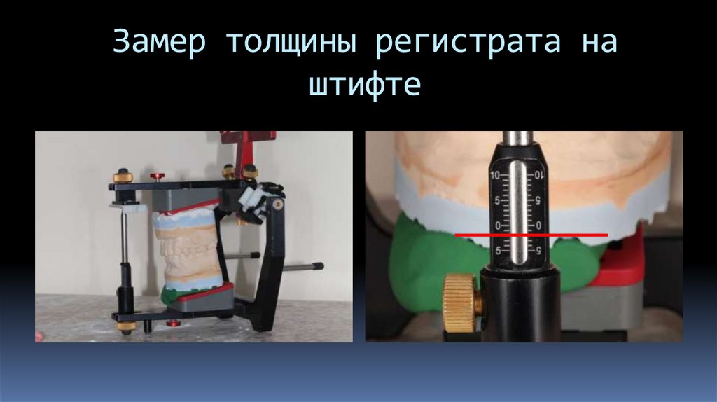 Замер толщины регистрата на штифте