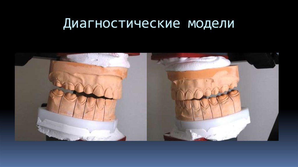 Диагностические модели