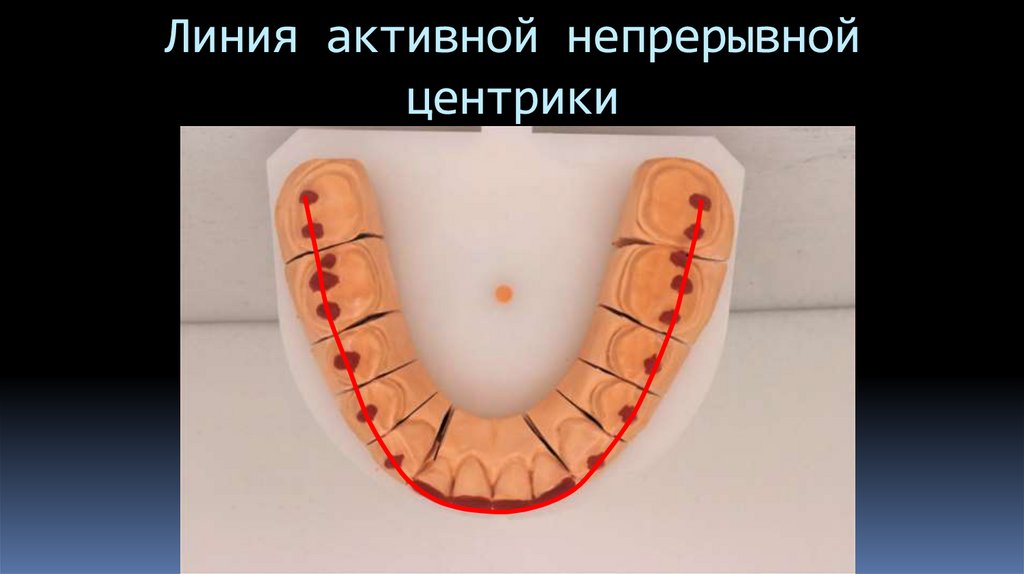 Линия активной непрерывной центрики