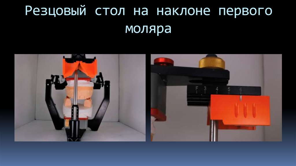 Резцовый стол на наклоне первого моляра
