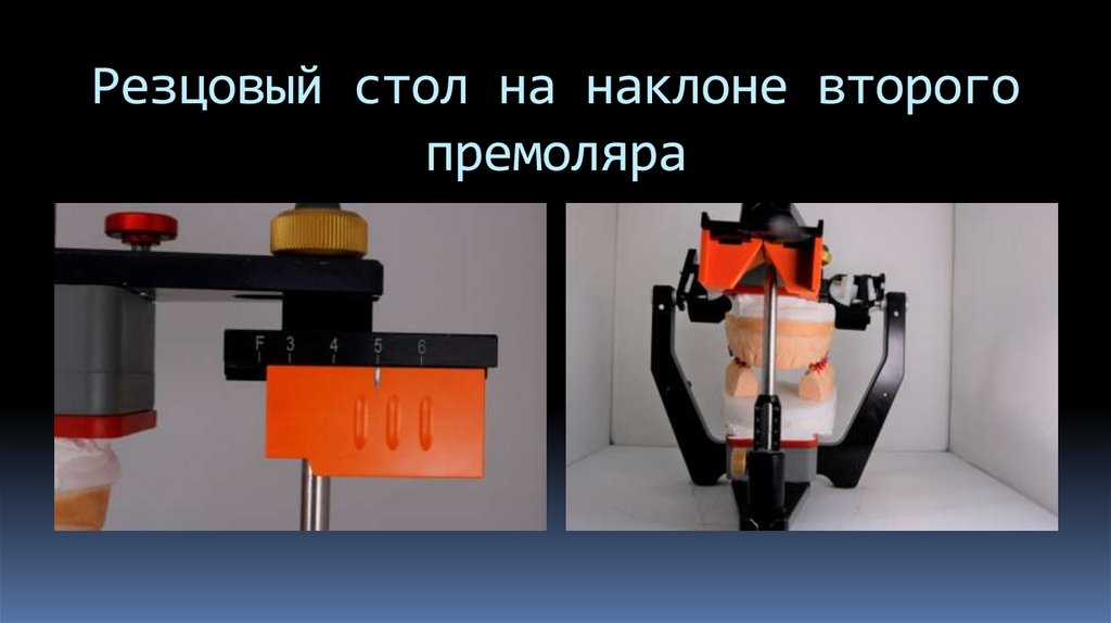 Резцовый стол на наклоне второго премоляра