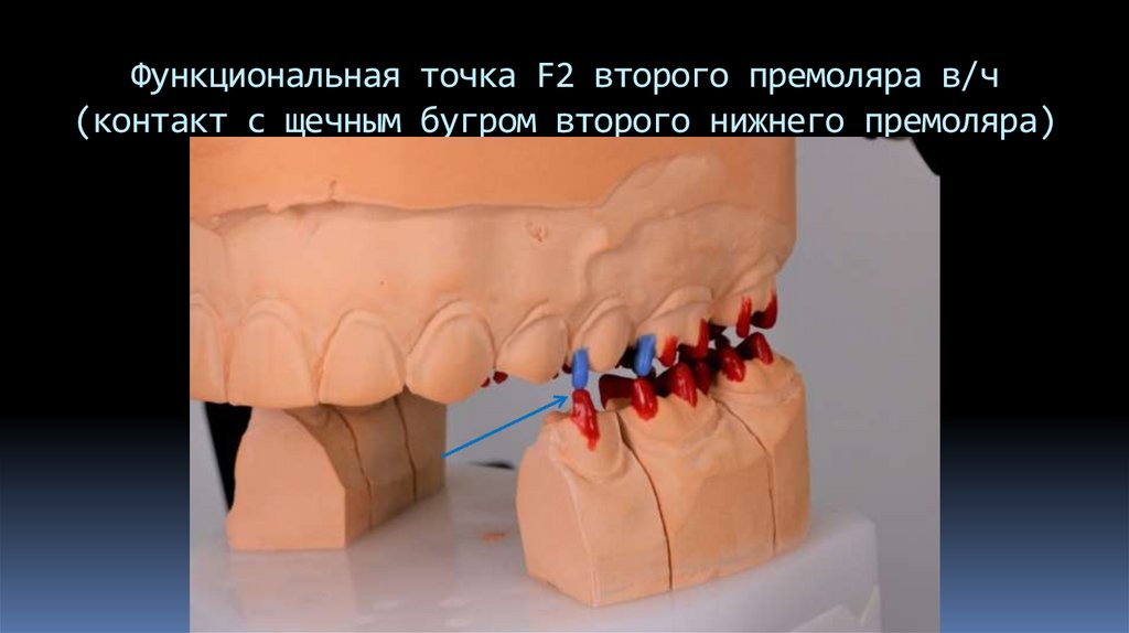 Функциональная точка F2 второго премоляра в/ч (контакт с щечным бугром второго нижнего премоляра)