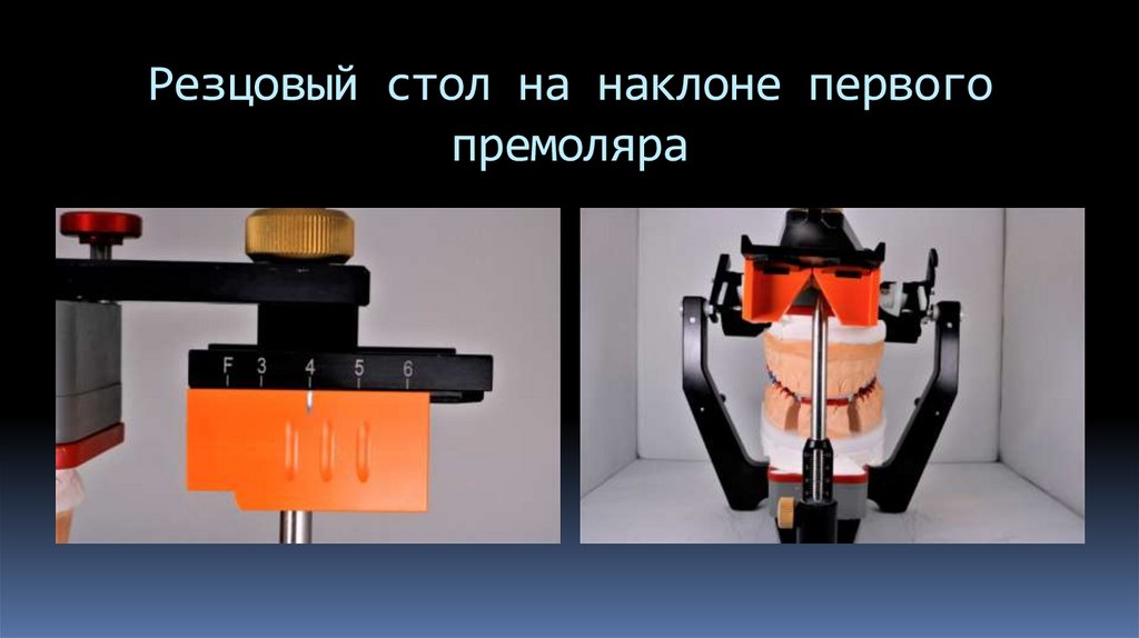 Резцовый стол на наклоне первого премоляра