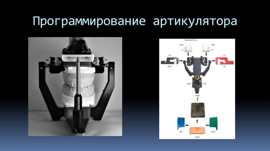 Программирование артикулятора