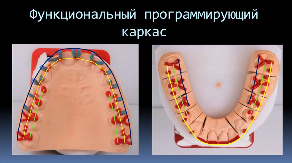 Функциональный программирующий каркас