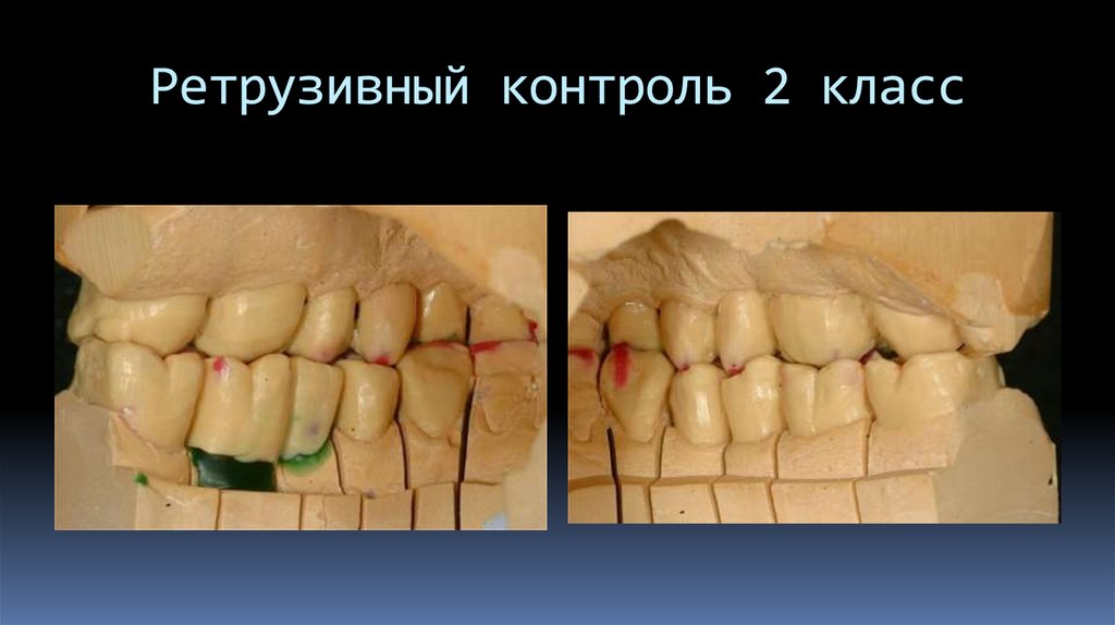 Ретрузивный контроль 2 класс
