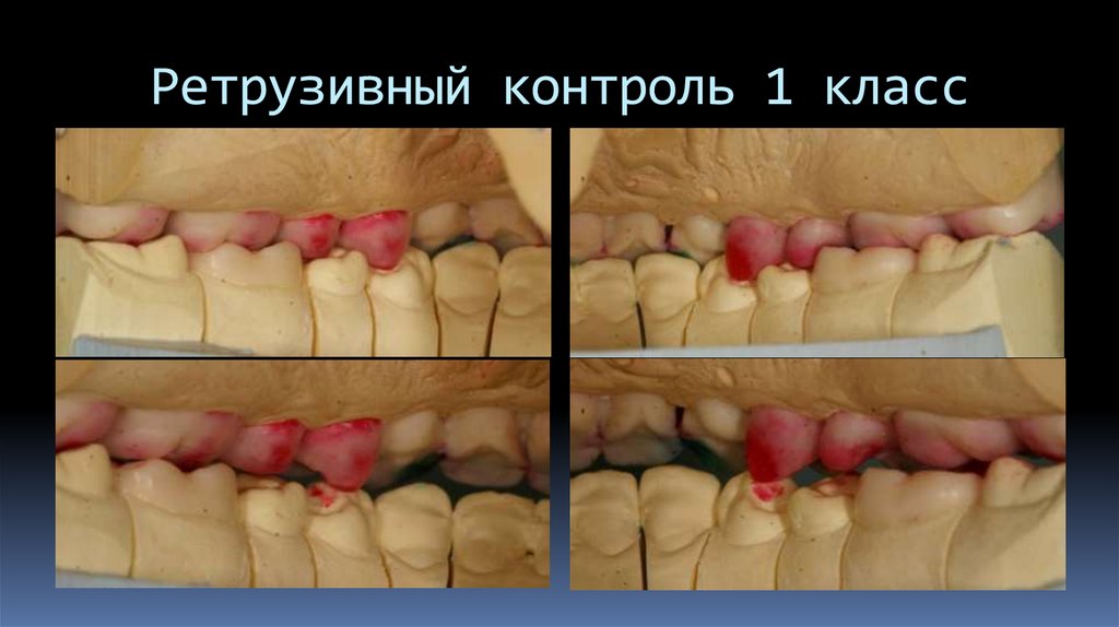 Ретрузивный контроль 1 класс