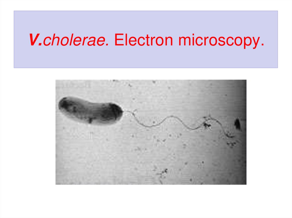 V.cholerae. Electron microscopy.