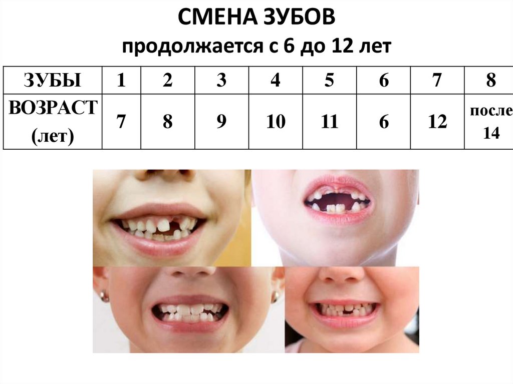 СМЕНА ЗУБОВ продолжается с 6 до 12 лет