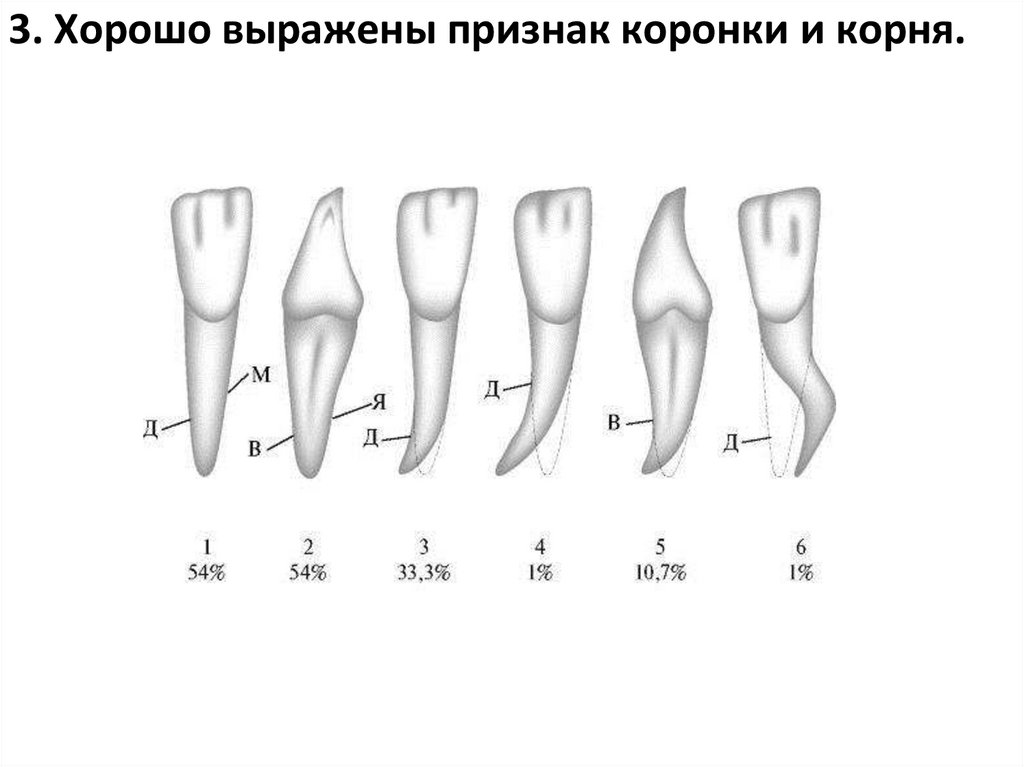3. Хорошо выражены признак коронки и корня.