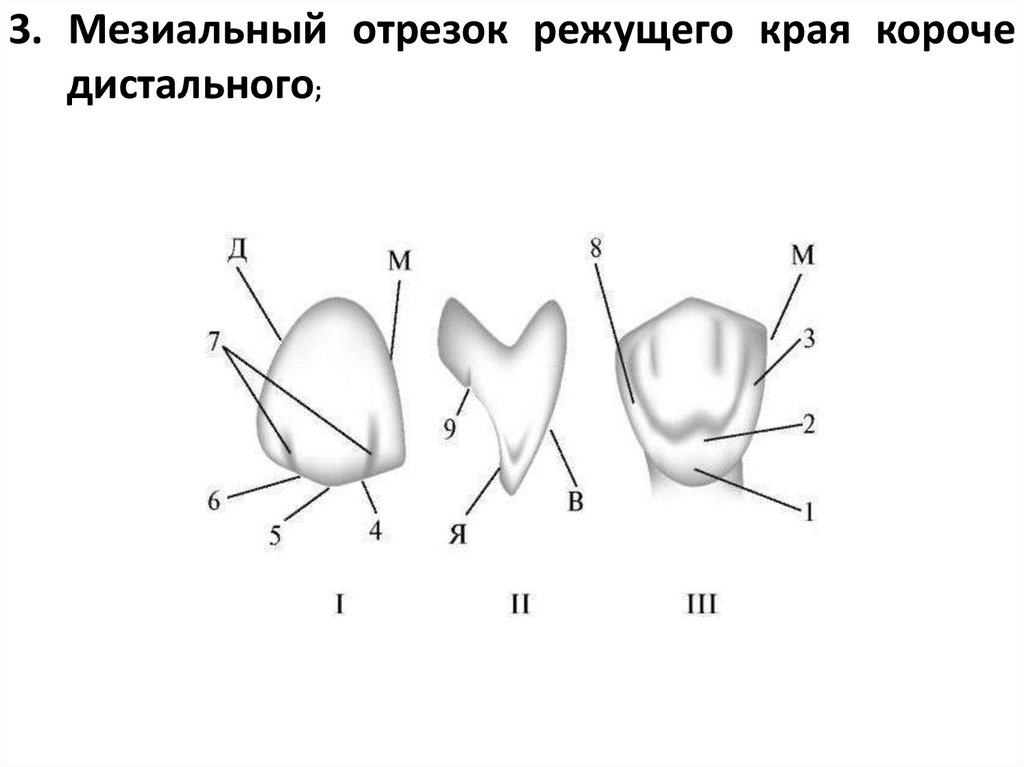 3. Мезиальный отрезок режущего края короче дистального;