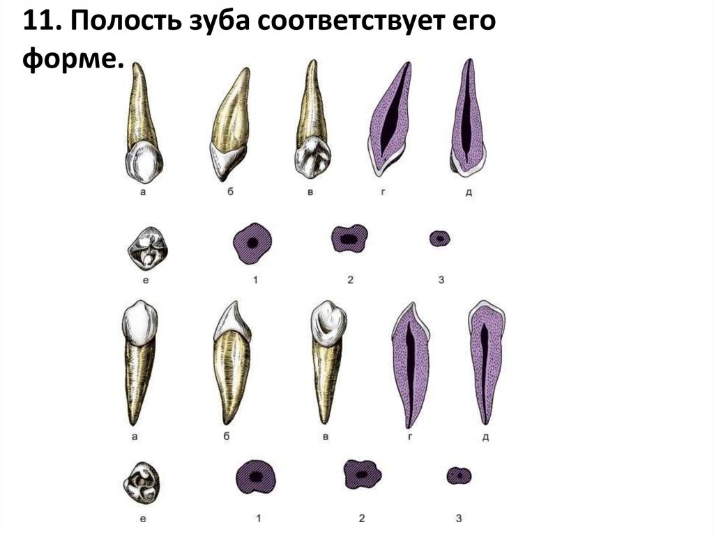 11. Полость зуба соответствует его форме.