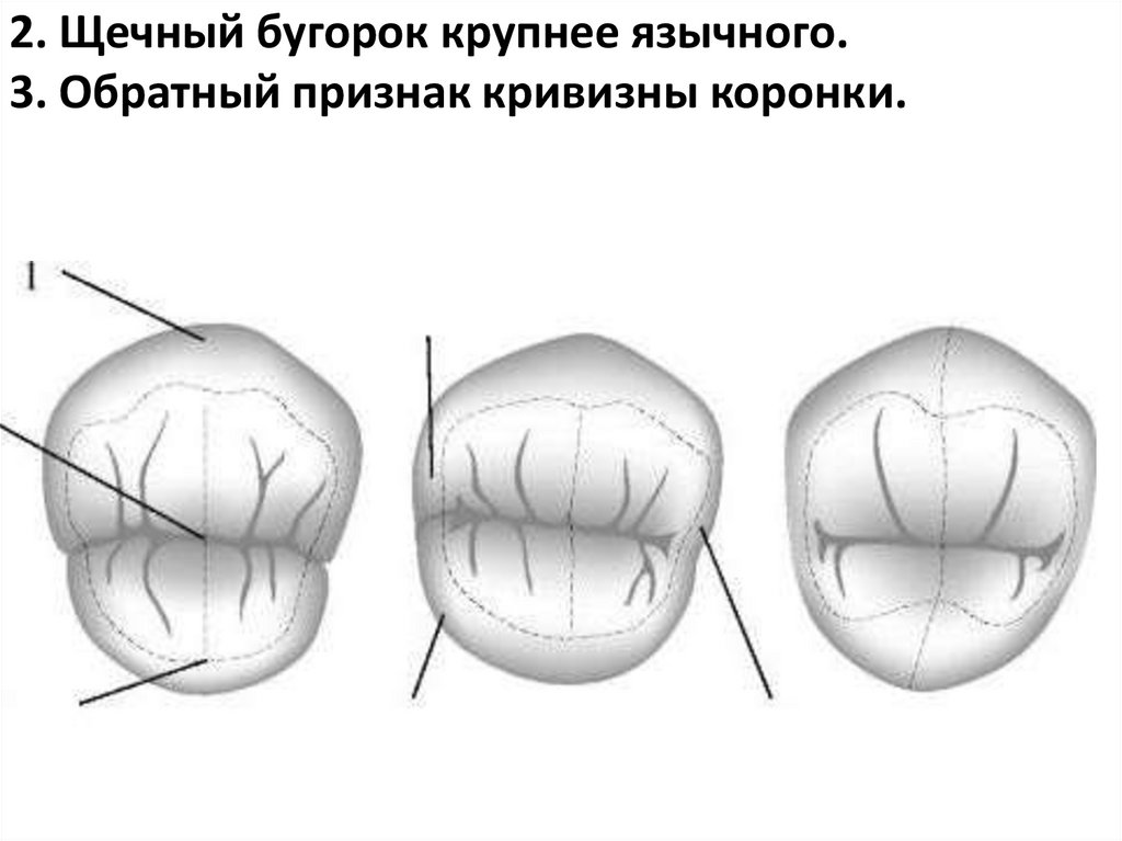 2. Щечный бугорок крупнее язычного.