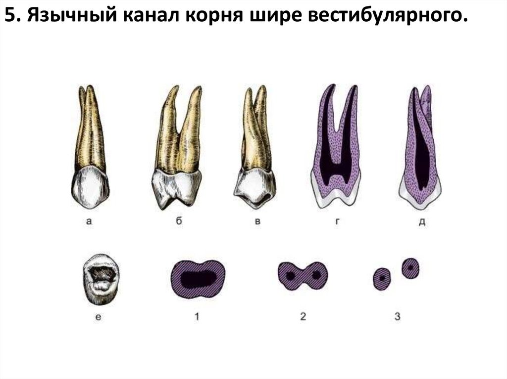 5. Язычный канал корня шире вестибулярного.