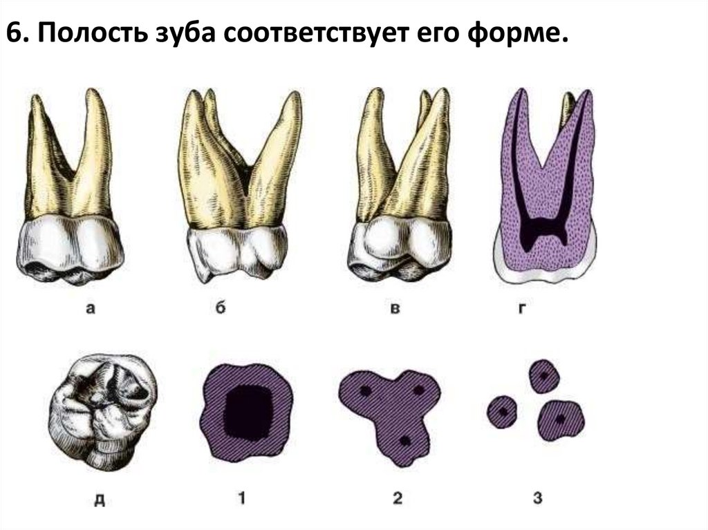 6. Полость зуба соответствует его форме.