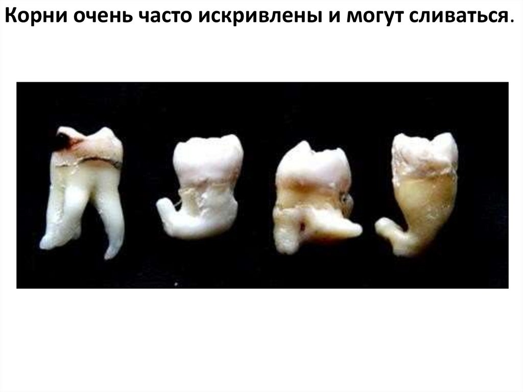 Корни очень часто искривлены и могут сливаться.