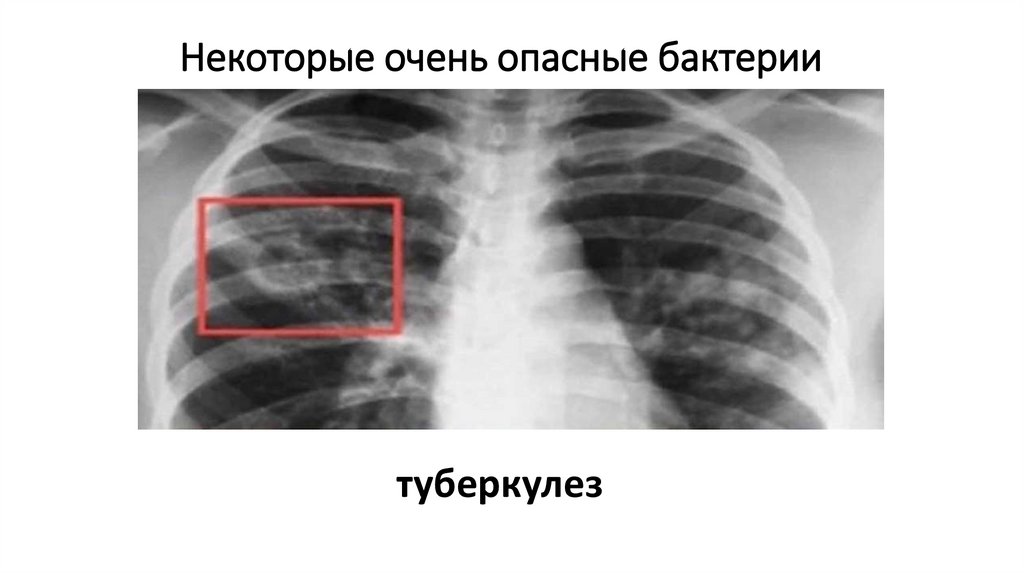Некоторые очень опасные бактерии