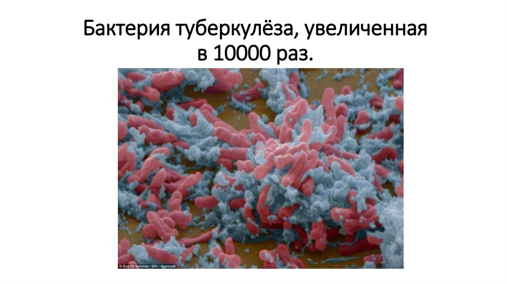 Бактерия туберкулёза, увеличенная в 10000 раз.