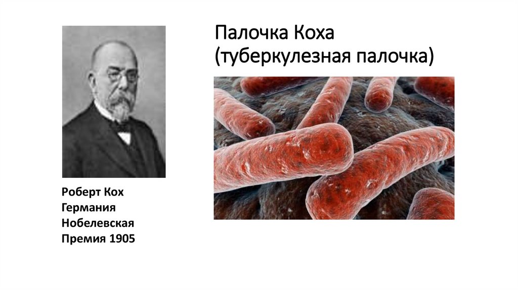 Палочка Коха (туберкулезная палочка)