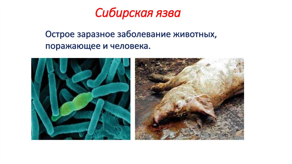 Сибирская язва