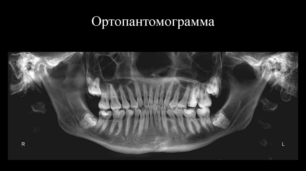 Ортопантомограмма
