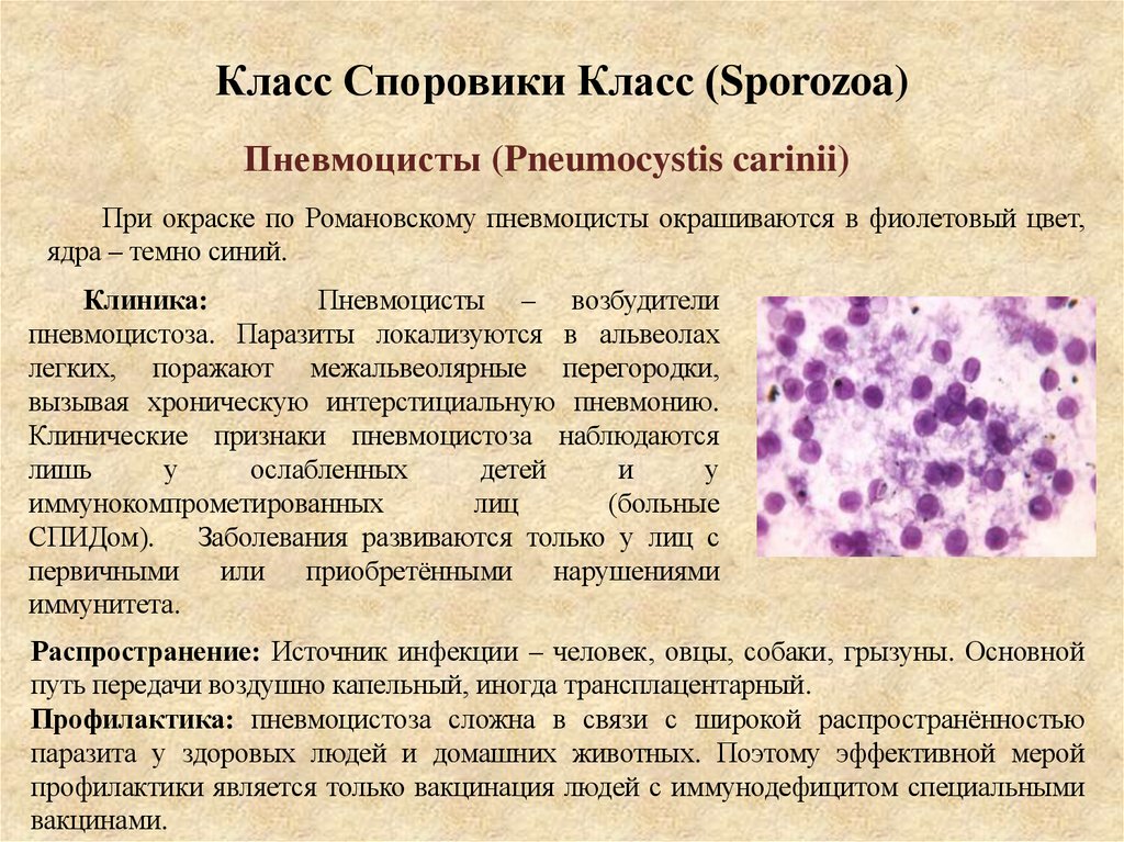 Класс Споровики Класс (Sporozoa)