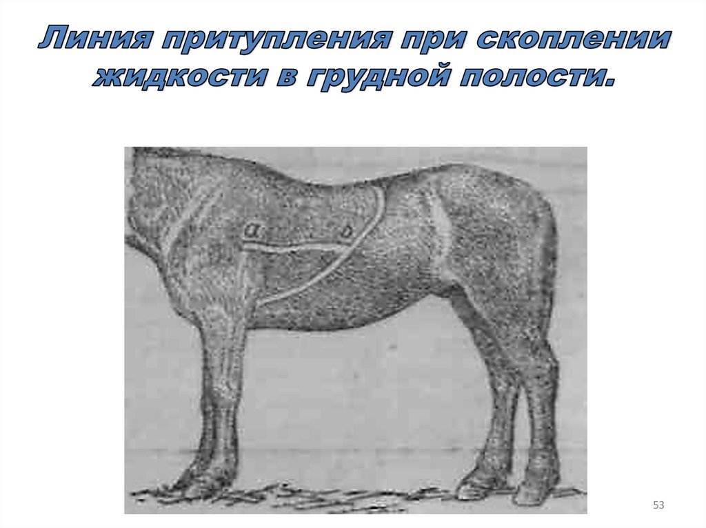 Линия притупления при скоплении жидкости в грудной полости.