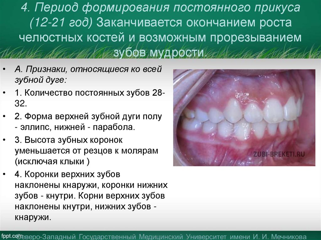4. Период формирования постоянного прикуса (12-21 год) Заканчивается окончанием роста челюстных костей и возможным