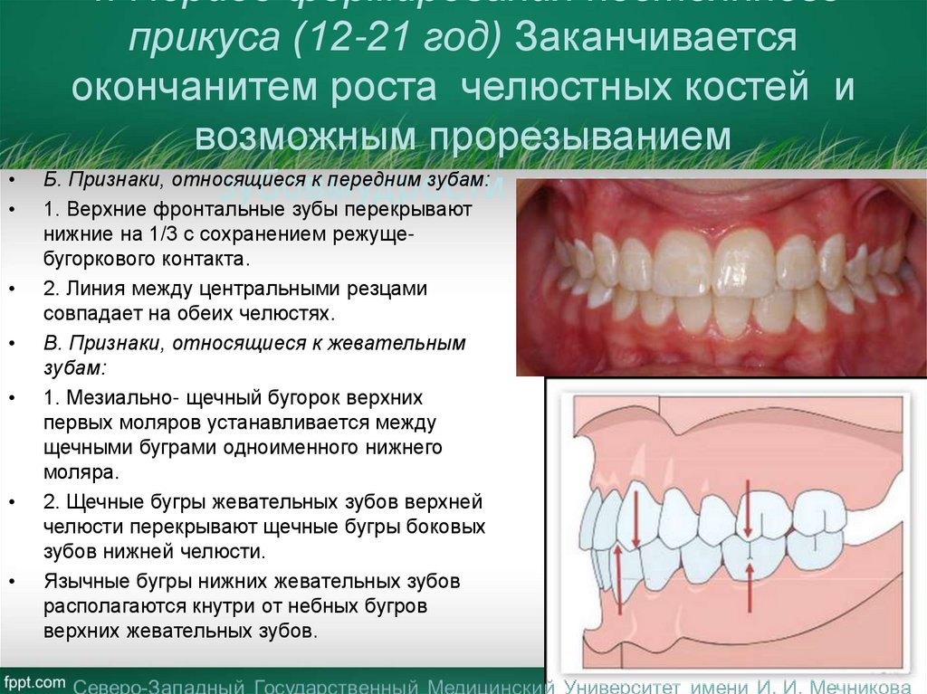 4. Период формирования постоянного прикуса (12-21 год) Заканчивается окончанитем роста челюстных костей и возможным