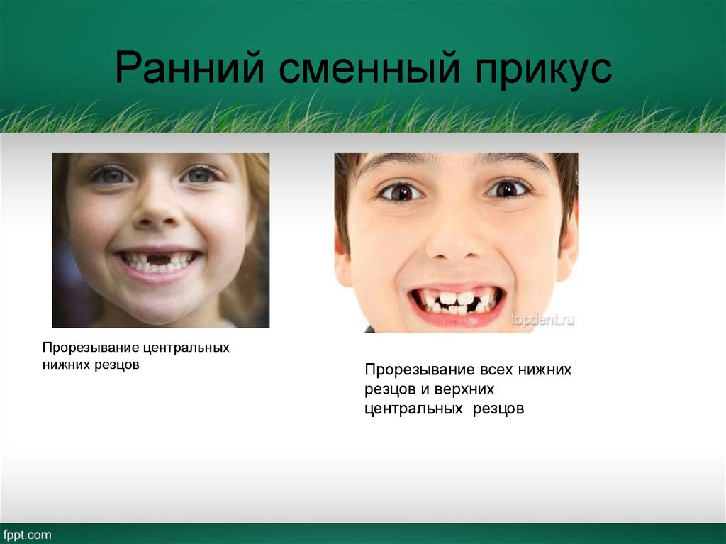 Ранний сменный прикус