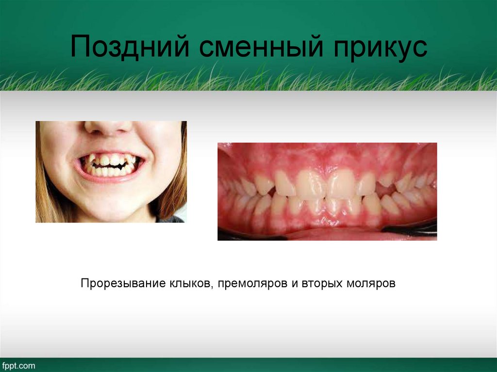 Поздний сменный прикус