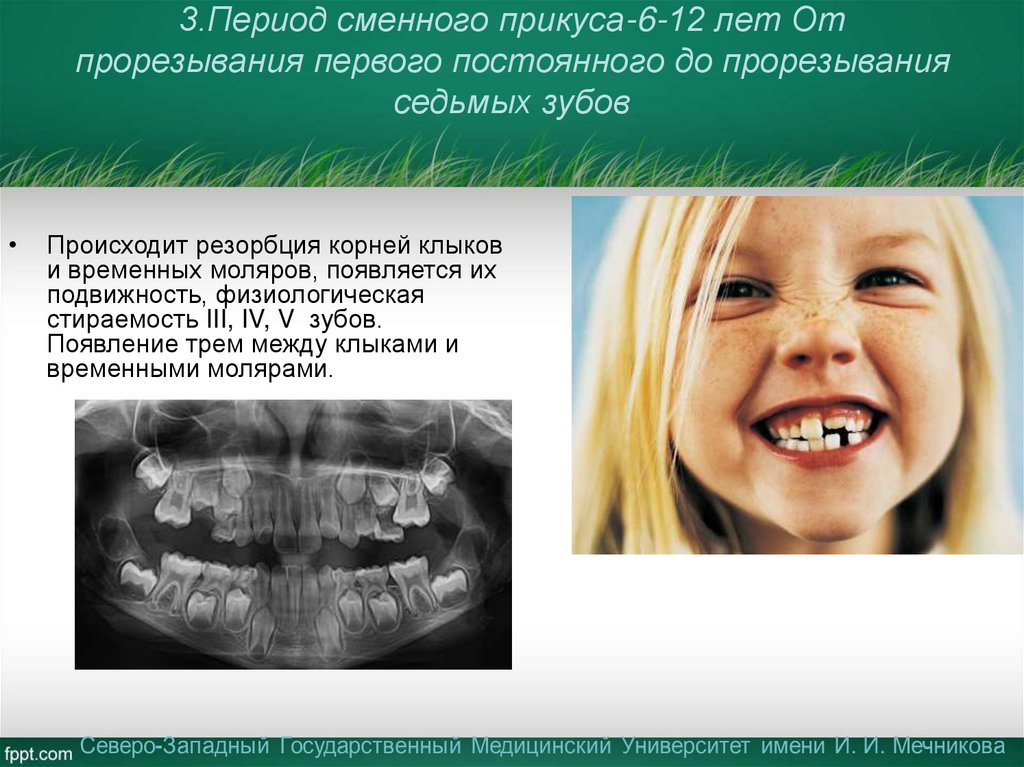 3.Период сменного прикуса-6-12 лет От прорезывания первого постоянного до прорезывания седьмых зубов
