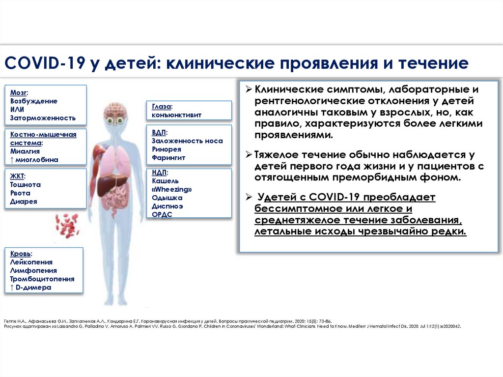 COVID-19 у детей: клинические проявления и течение