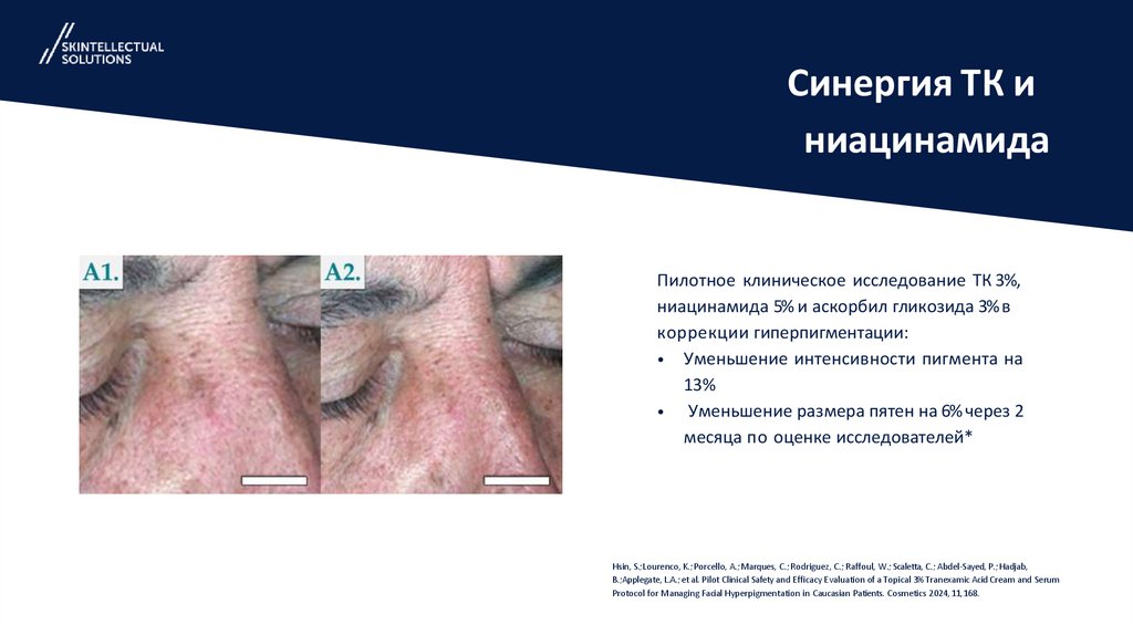 Синергия ТК и ниацинамида