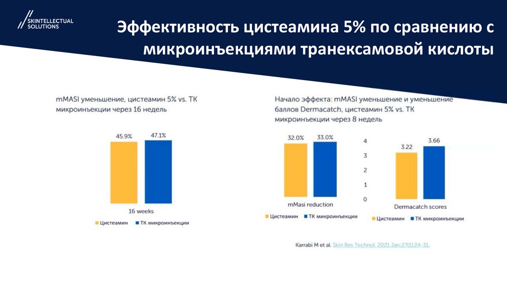 Эффективность цистеамина 5% по сравнению с микроинъекциями транексамовой кислоты