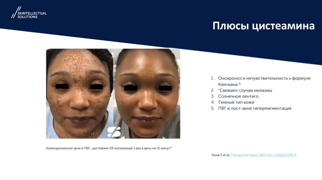 Плюсы цистеамина