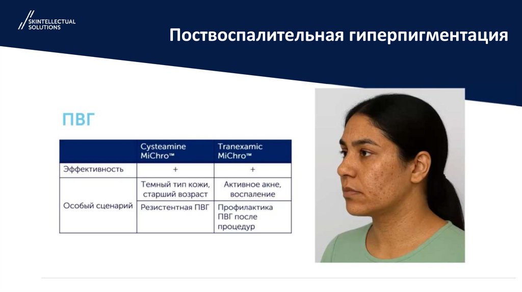 Поствоспалительная гиперпигментация