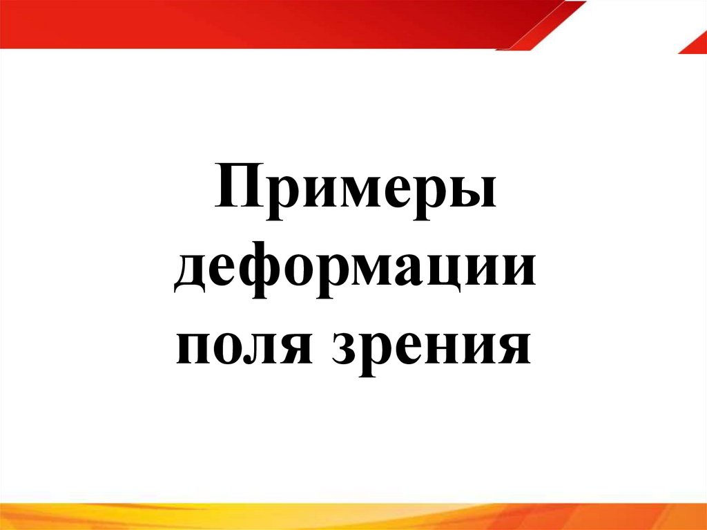 Примеры деформации поля зрения
