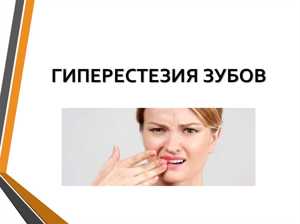 ГИПЕРЕСТЕЗИЯ ЗУБОВ