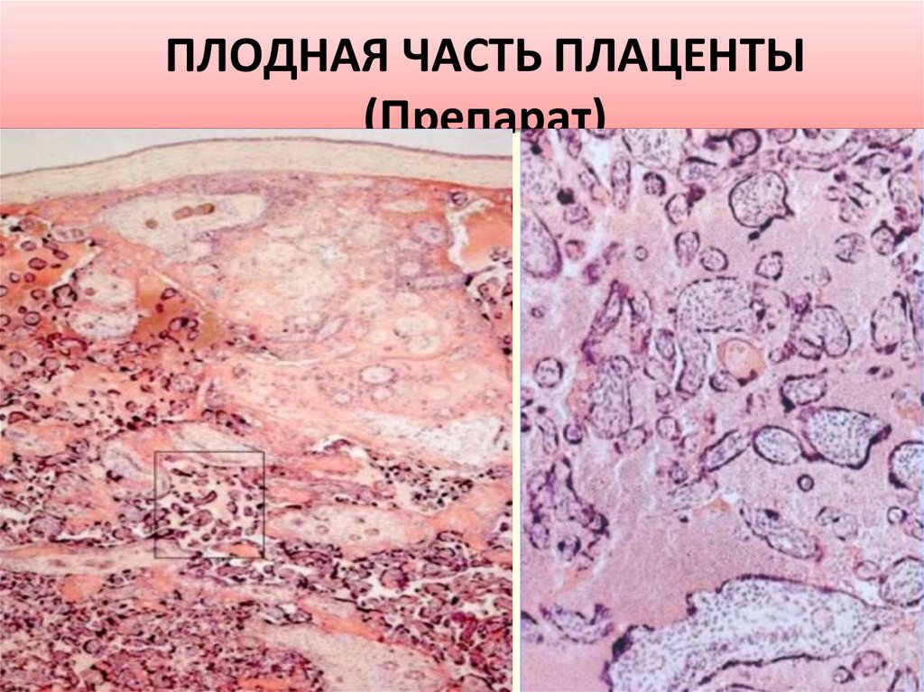 ПЛОДНАЯ ЧАСТЬ ПЛАЦЕНТЫ (Препарат)