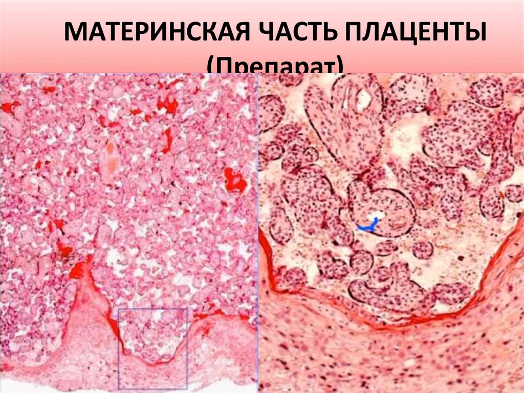 МАТЕРИНСКАЯ ЧАСТЬ ПЛАЦЕНТЫ (Препарат)