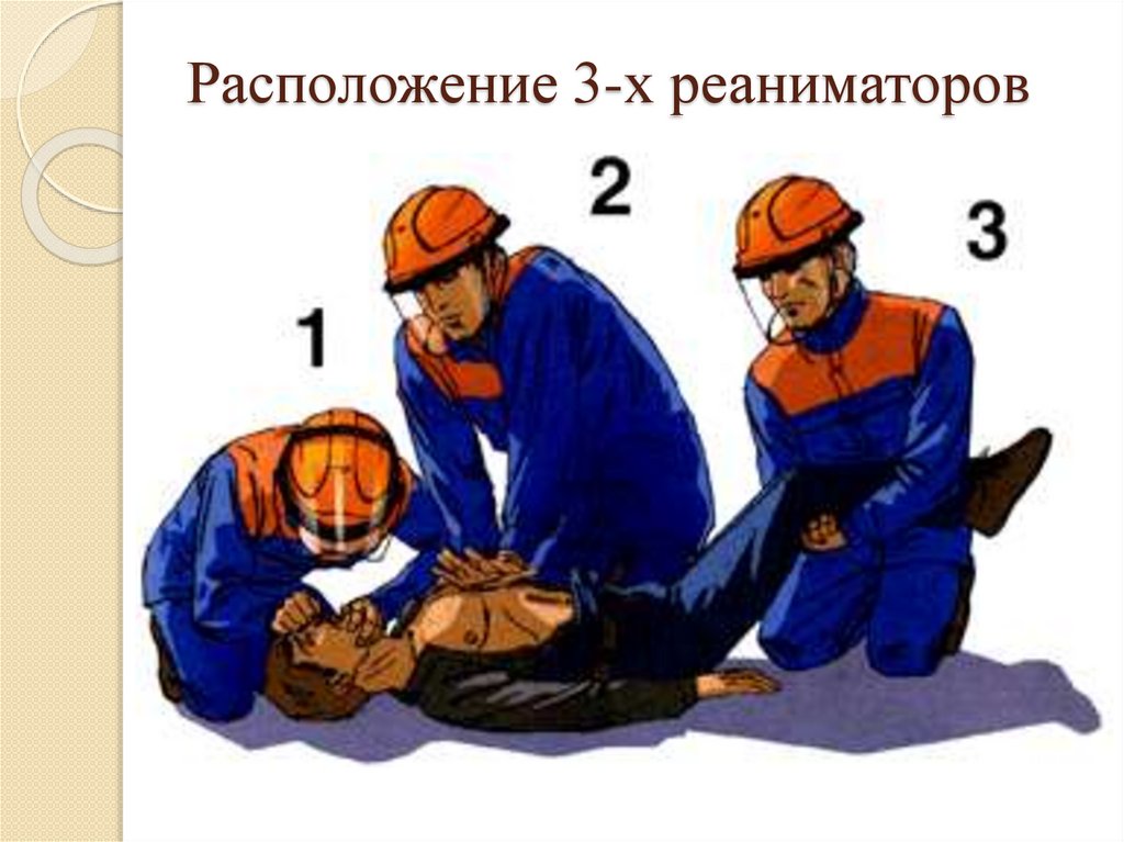 Расположение 3-х реаниматоров