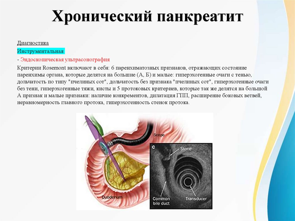 Хронический панкреатит