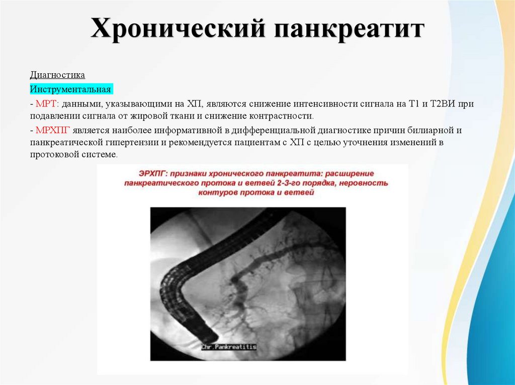 Хронический панкреатит