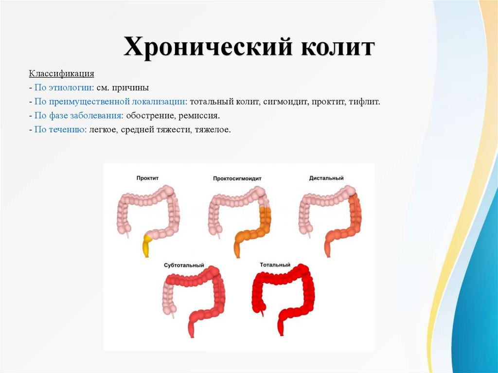 Хронический колит