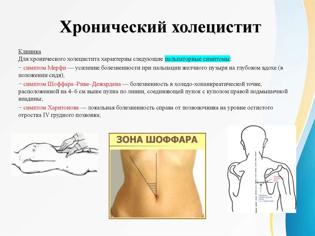 Хронический холецистит